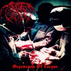 Septicemia of Corpse